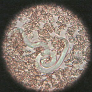Microfilaria as seen under the microscope